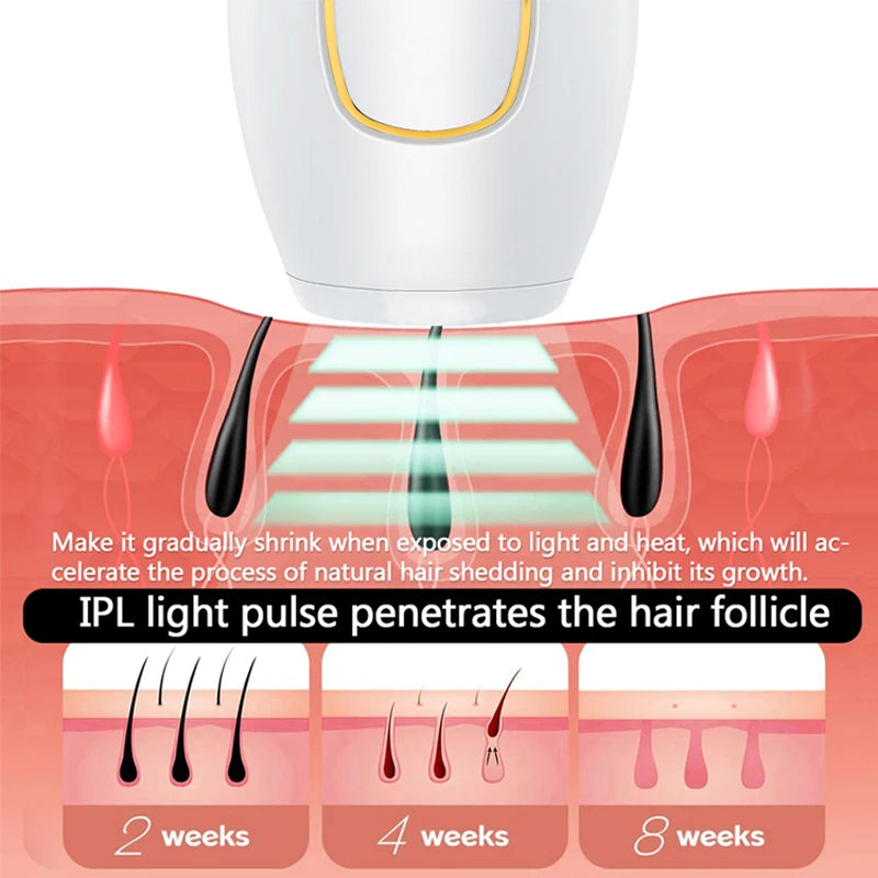 Depilación láser permanente profesional IPL